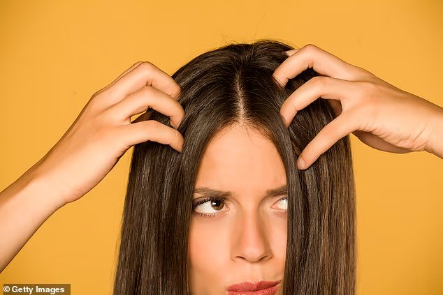 How to beat dandruff and flaky scalp this winter An expert reveals the popular treatment that can increase irritation and redness - and when to see a doctor to avoid permanent hair loss How to beat dandruff and flaky scalp this winter An expert reveals the popular treatment that can increase irritation and redness - and when to see a doctor to avoid permanent hair loss