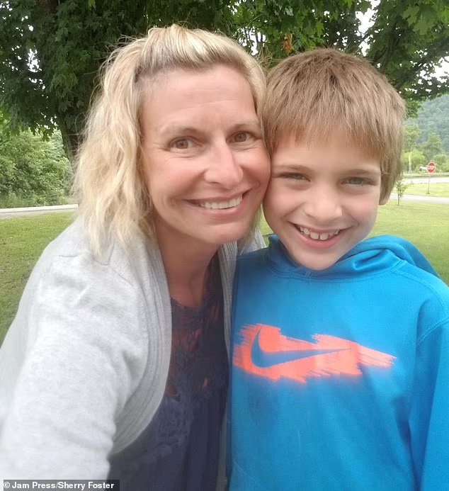 Mom issues warning ahead of Christmas as she claims light-up shoes leaked acid and burned her sons feet