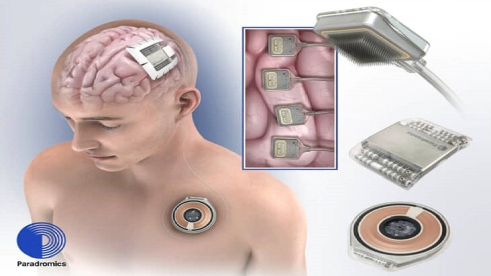 Russian academic Developing brain chips is possible in Russia, but needs legal regulation