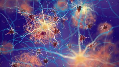 Shingles Vaccine Cuts Dementia Risk by 20%, Stanford Study Reveals