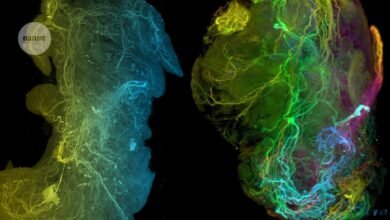 Pancreatic cancer is evasive. Is the nervous system the reason why?