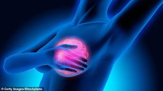My breast implants saved my life TERESA BROOKS found a tiny lump that turned out to be cancer - all thanks to her enhancement surgery. Here she reveals the signs so many women miss My breast implants saved my life TERESA BROOKS found a tiny lump that turned out to be cancer - all thanks to her enhancement surgery. Here she reveals the signs so many women miss