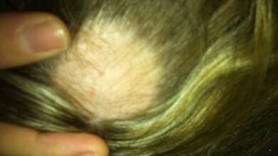 Ive battled hair loss since my late 30s. Now, in my 50s, Ive finally discovered a solution… This is the secret ALL women need to know