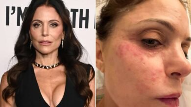 Bethenny Frankel Says She Will Never Use a Hotel Towel Again After Bacterial Infection