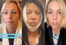 Couple Goes Viral After Husband Documents Wifes New Face Transformation (Exclusive)