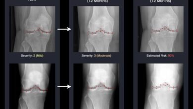 AI Brings Tomorrow’s X-Rays to Life, Helping Doctors Fight Arthritis Sooner