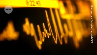 Putting immune cells into ‘night mode’ reduces heart-attack damage