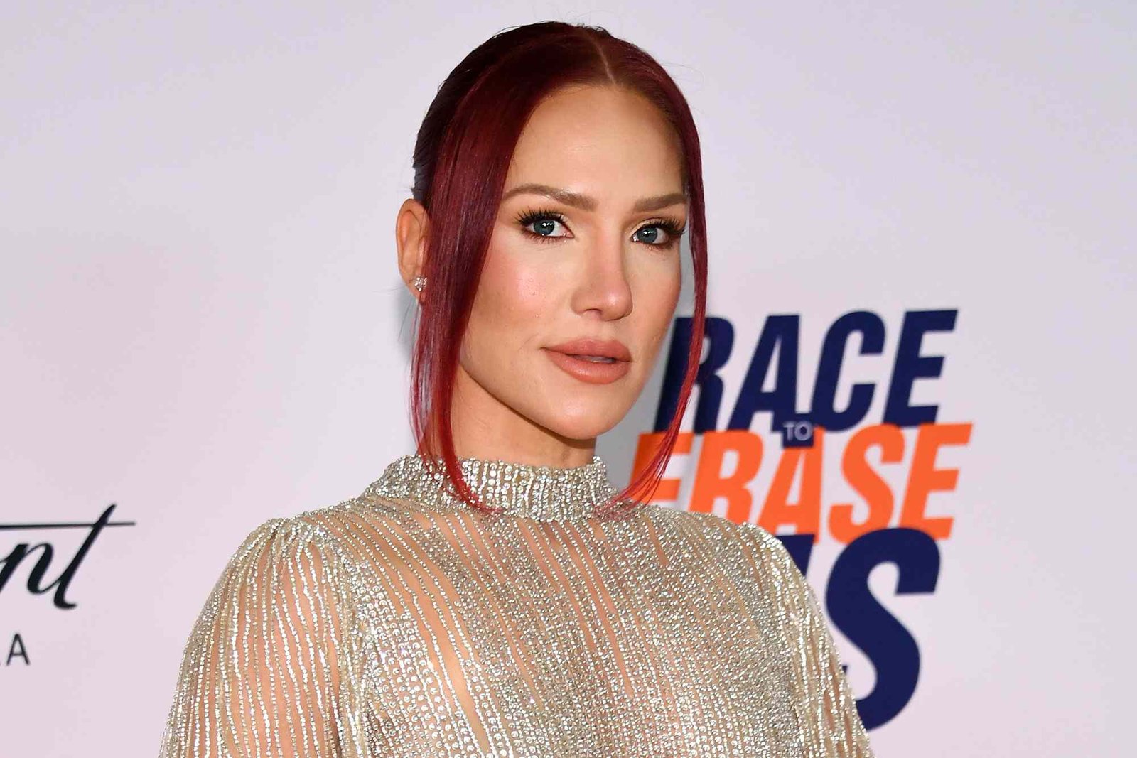 DWTS Alum Sharna Burgess Recalls Past Eating Disorder