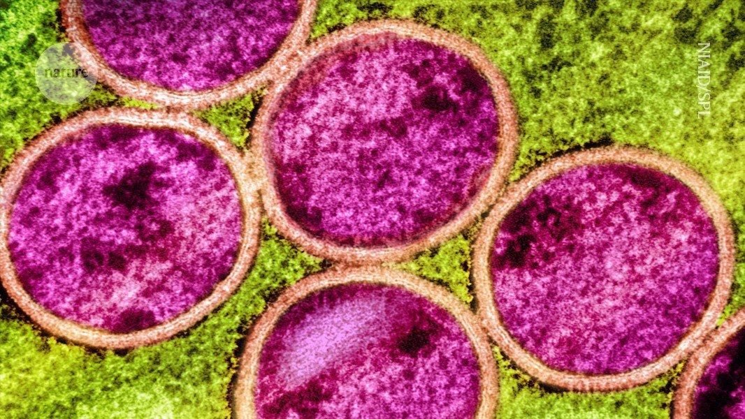 هل سيصبح mpox عالميًا مرة أخرى؟ تظهر الأبحاث أنها تتطور بطرق غريبة هل سيصبح mpox عالميًا مرة أخرى؟ تظهر الأبحاث أنها تتطور بطرق غريبة